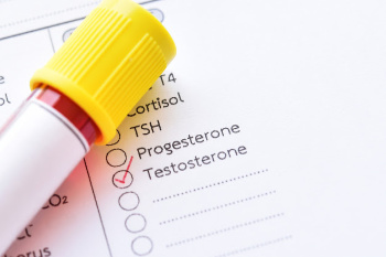 Peyronie’s Disease: Testosterone Levels Not Linked to Extent of Penis Curve